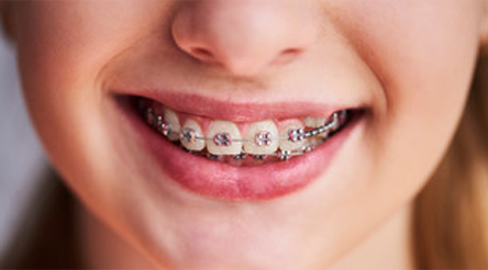 ORTHODONTICS